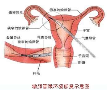 通草的功效与作用能通输卵管堵塞,系统解答解释落实_入门版77.274